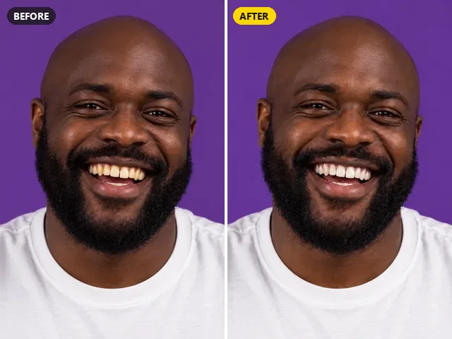 Before and after teeth whitening on a smiling bearded man against a purple background