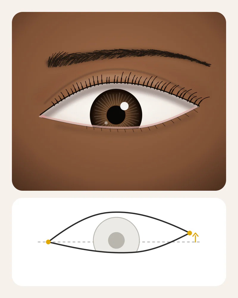 Illustration of upturned eyes: the outer corner sits clearly higher than the inner corner