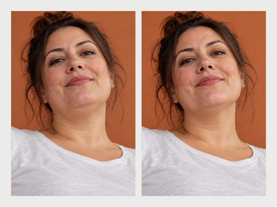 Smiling woman holding her hair back, before and after the double chin under her jaw was softened