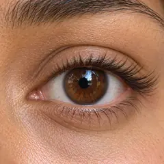 Cat Eye